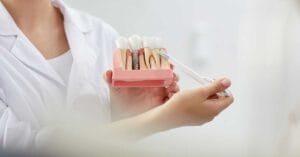 Implantologia a carico immediato: controindicazioni e rischi 1 Implantologia a carico immediato