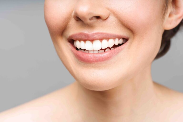 Differenze trattamenti di estetica dentale