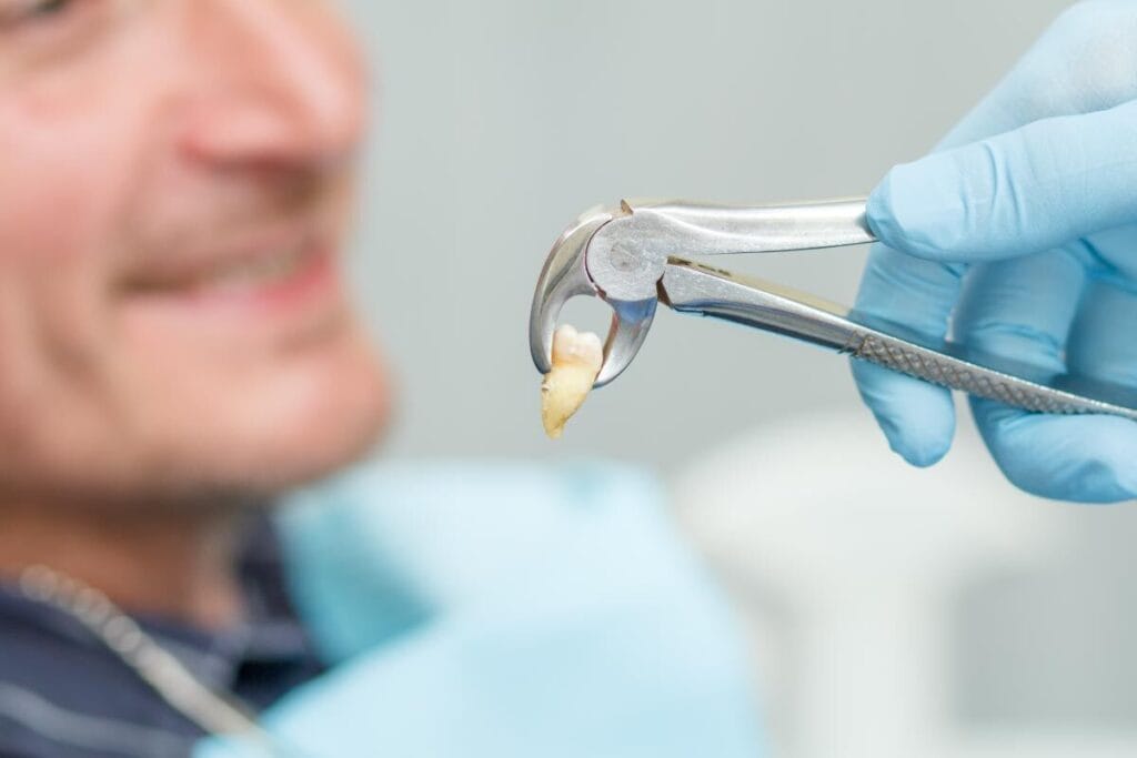 Estrarre un dente fa male? Scopri di più sull’estrazione 15 estrarre un dente fa male news